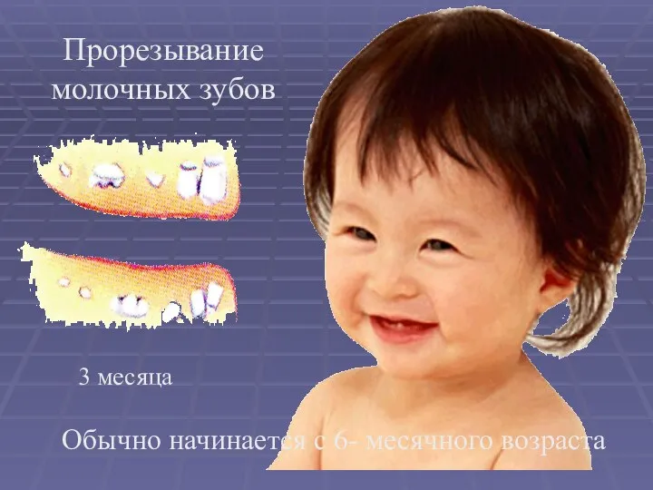 Обычно начинается с 6- месячного возраста 3 месяца Прорезывание молочных зубов