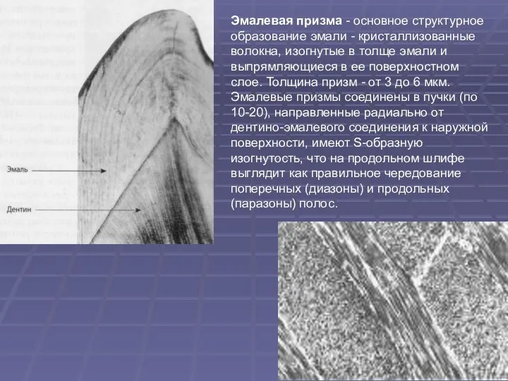 Эмалевая призма - основное структурное образование эмали - кристаллизованные волокна, изогнутые в