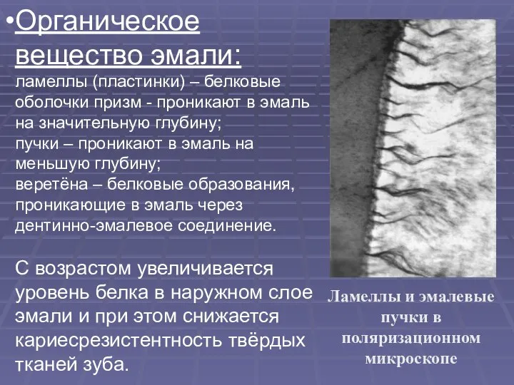 Ламеллы и эмалевые пучки в поляризационном микроскопе Органическое вещество эмали: ламеллы (пластинки)