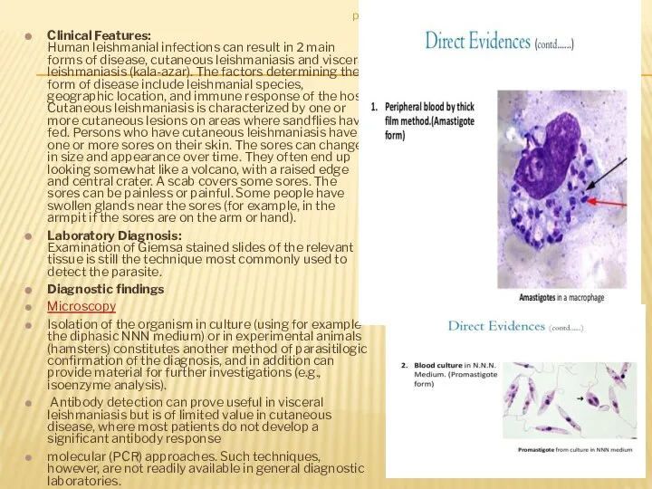 Clinical Features: Human leishmanial infections can result in 2 main forms of