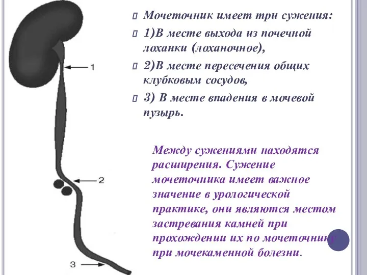 Мочеточник имеет три сужения: 1)В месте выхода из почечной лоханки (лоханочное), 2)В