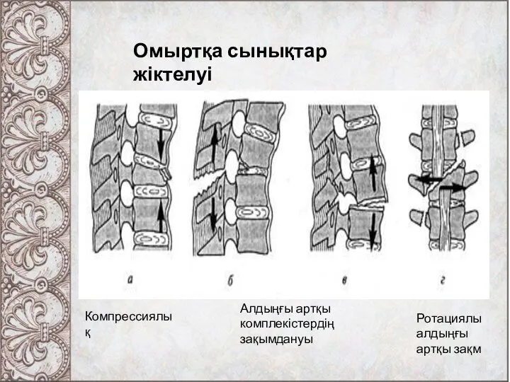 Омыртқа сынықтар жіктелуі Компрессиялық Алдыңғы артқы комплекістердің зақымдануы Ротациялы алдыңғы артқы зақм