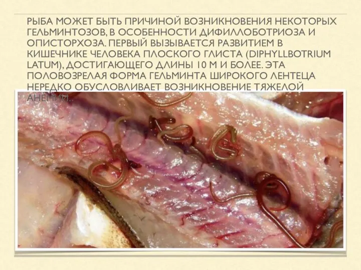РЫБА МОЖЕТ БЫТЬ ПРИЧИНОЙ ВОЗНИКНОВЕНИЯ НЕКОТОРЫХ ГЕЛЬМИНТОЗОВ, В ОСОБЕННОСТИ ДИФИЛЛОБОТРИОЗА И ОПИСТОРХОЗА.