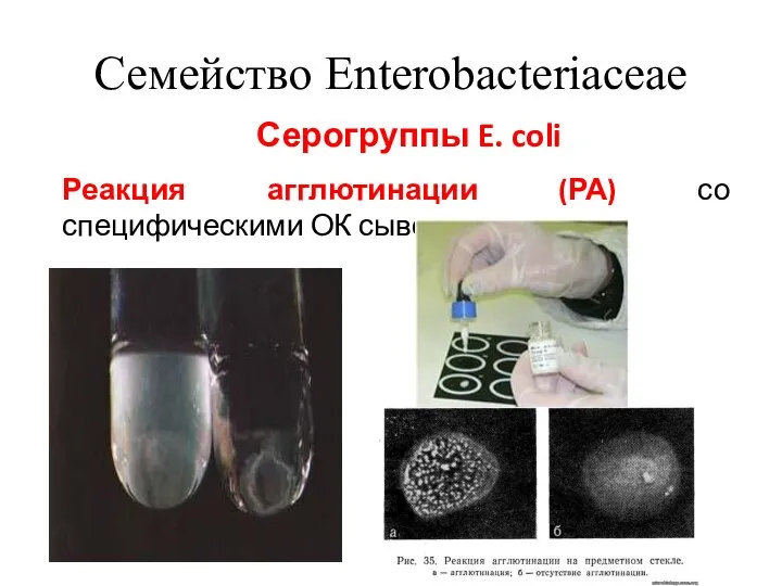 Семейство Enterobacteriaceae Серогруппы E. coli Реакция агглютинации (РА) со специфическими ОК сыворотками