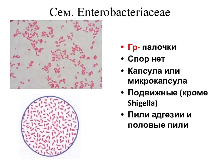 Сем. Enterobacteriaceae Гр- палочки Спор нет Капсула или микрокапсула Подвижные (кроме Shigella)