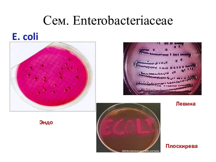 Сем. Enterobacteriaceae E. coli Эндо Плоскирева Левина
