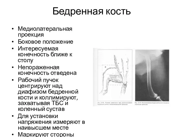 Бедренная кость Медиолатеральная проекция Боковое положение Интересуемая конечность ближе к столу Непораженная