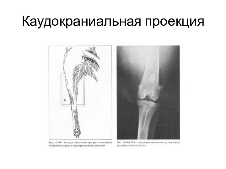 Каудокраниальная проекция