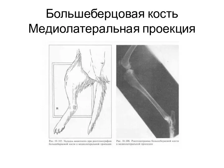 Большеберцовая кость Медиолатеральная проекция