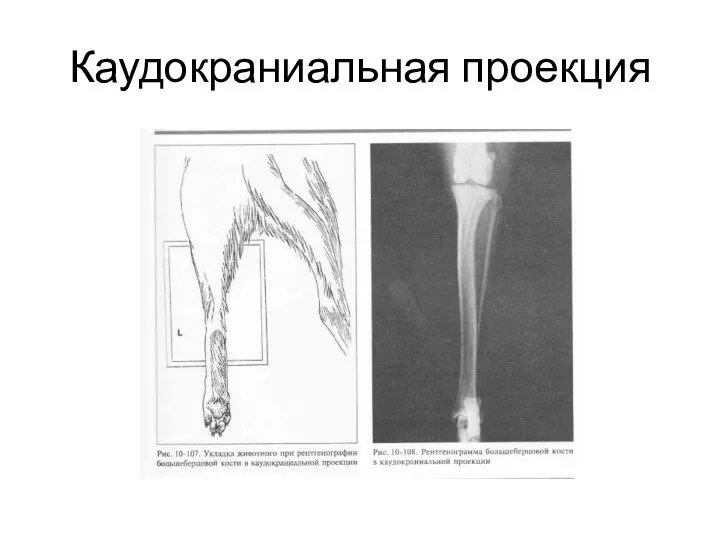 Каудокраниальная проекция