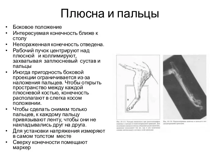 Плюсна и пальцы Боковое положение Интересуемая конечность ближе к столу Непораженная конечность