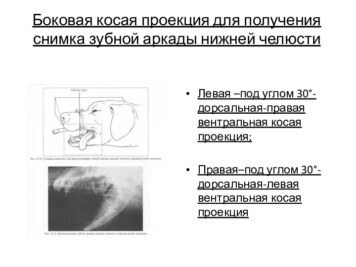 Боковая косая проекция для получения снимка зубной аркады нижней челюсти Левая –под