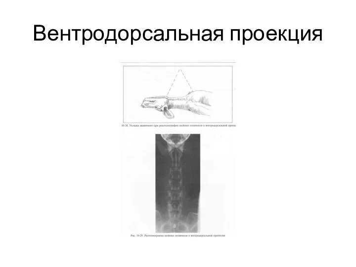 Вентродорсальная проекция