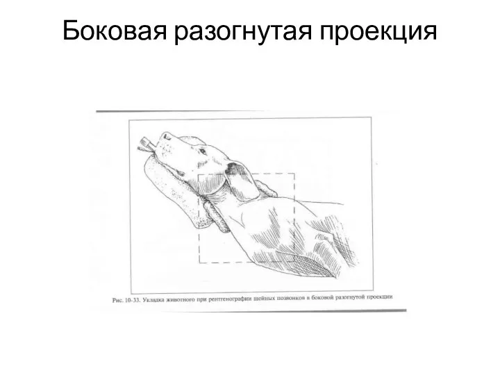 Боковая разогнутая проекция