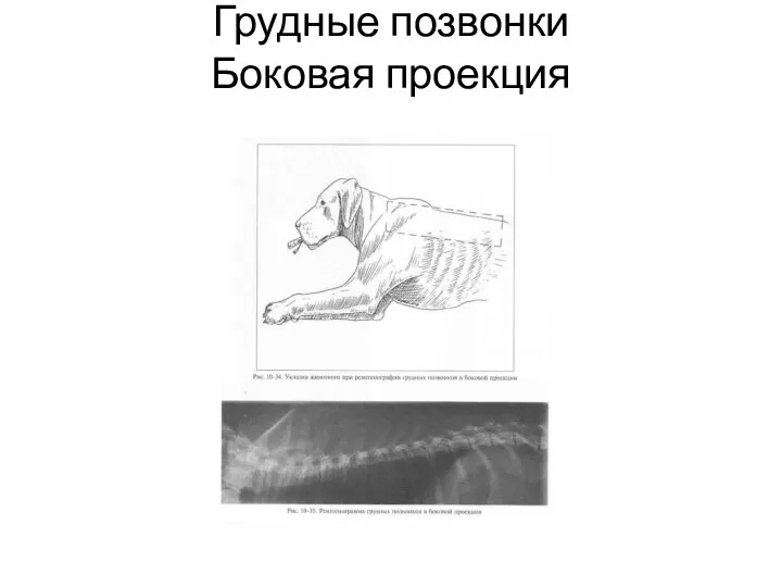 Грудные позвонки Боковая проекция