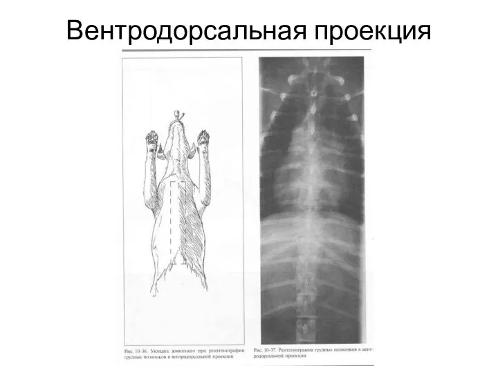 Вентродорсальная проекция