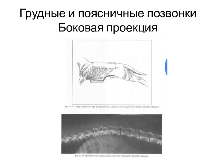 Грудные и поясничные позвонки Боковая проекция