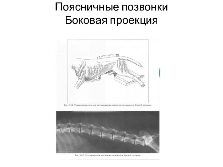 Поясничные позвонки Боковая проекция