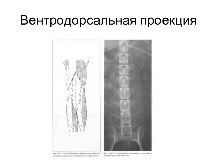 Вентродорсальная проекция