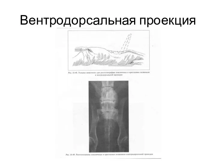 Вентродорсальная проекция