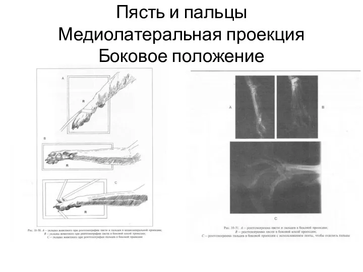 Пясть и пальцы Медиолатеральная проекция Боковое положение