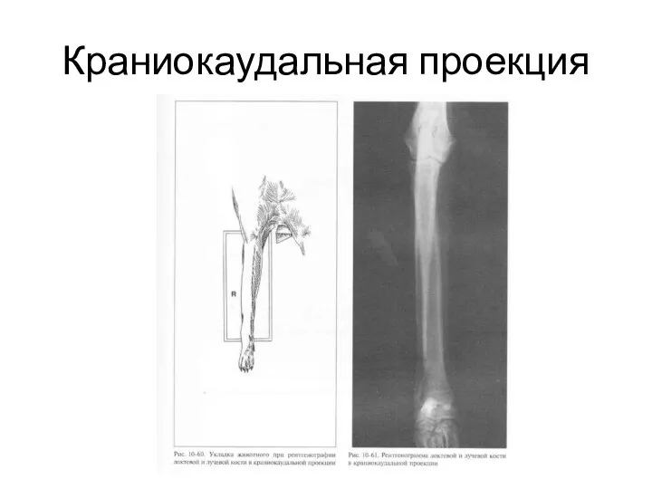 Краниокаудальная проекция