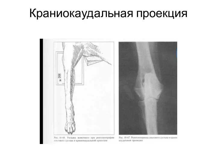 Краниокаудальная проекция