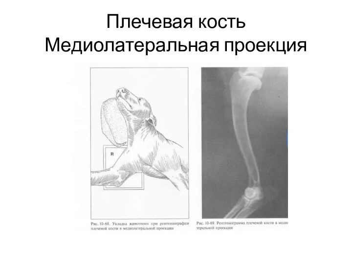 Плечевая кость Медиолатеральная проекция