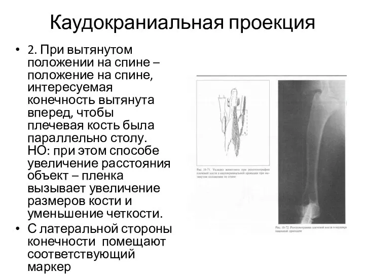 Каудокраниальная проекция 2. При вытянутом положении на спине – положение на спине,