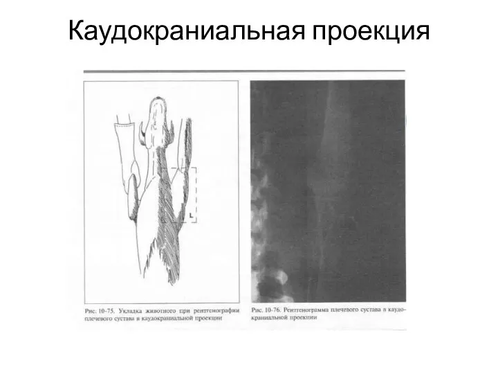 Каудокраниальная проекция