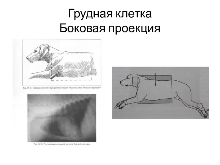 Грудная клетка Боковая проекция