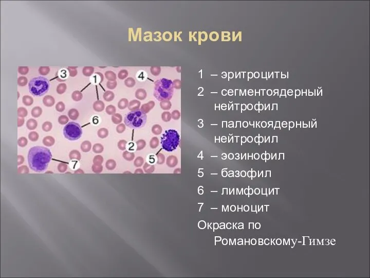 Мазок крови 1 – эритроциты 2 – сегментоядерный нейтрофил 3 – палочкоядерный