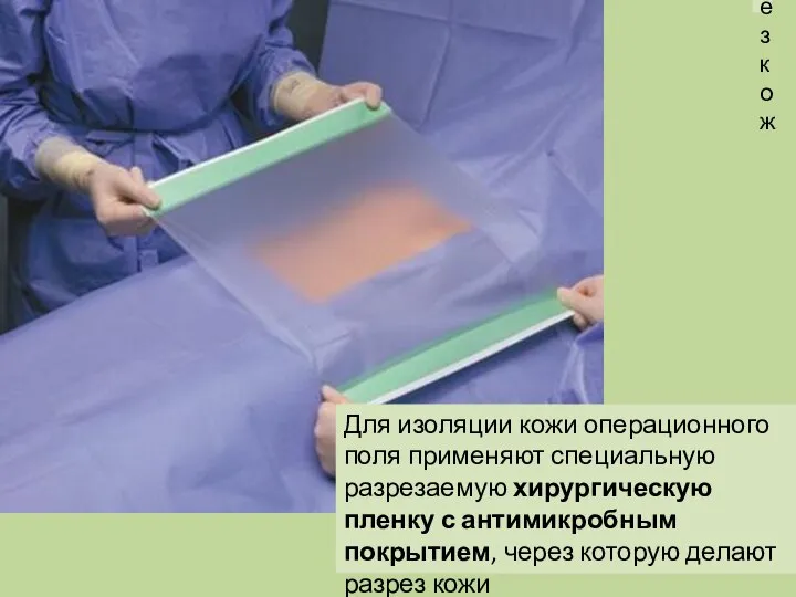 разрез кож Для изоляции кожи операционного поля применяют специальную разрезаемую хирургическую пленку
