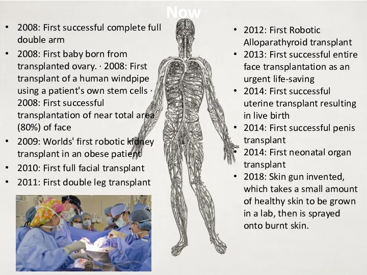 Now 2008: First successful complete full double arm 2008: First baby born