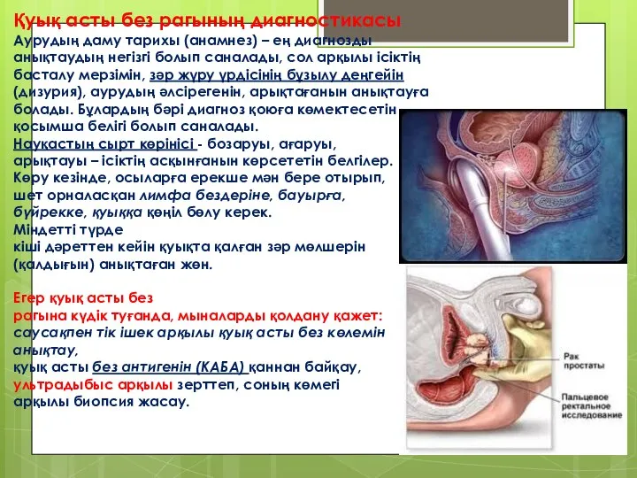 Қуық асты без рагының диагностикасы Аурудың даму тарихы (анамнез) – ең диагнозды