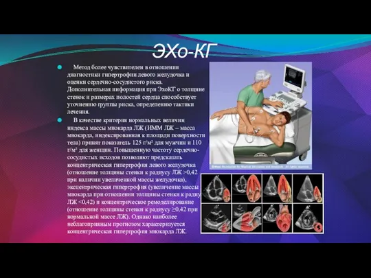 ЭХо-КГ Метод более чувствителен в отношении диагностики гипертрофии левого желудочка и оценки