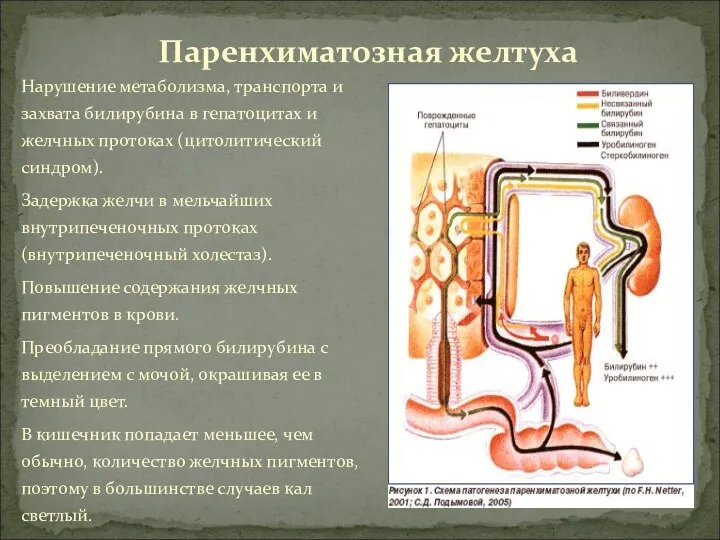 Нарушение метаболизма, транспорта и захвата билирубина в гепатоцитах и желчных протоках (цитолитический