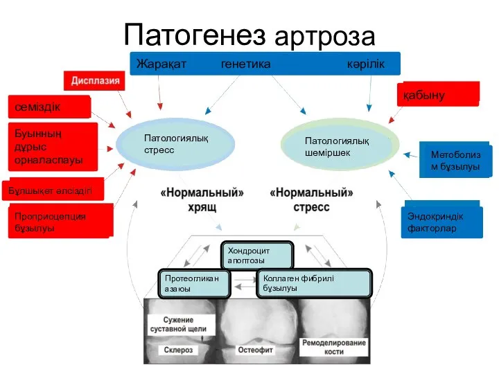 Патогенез артроза Жарақат генетика кәрілік семіздік Буынның дұрыс орналаспауы Бұлшықет әлсіздігі Проприоцепция