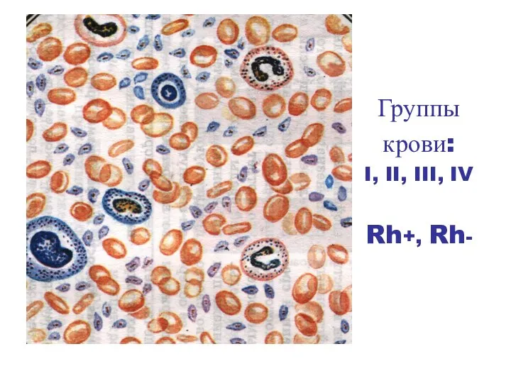 Группы крови: I, II, III, IV Rh+, Rh-