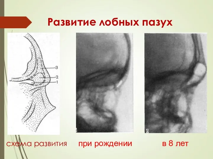 Развитие лобных пазух схема развития при рождении в 8 лет