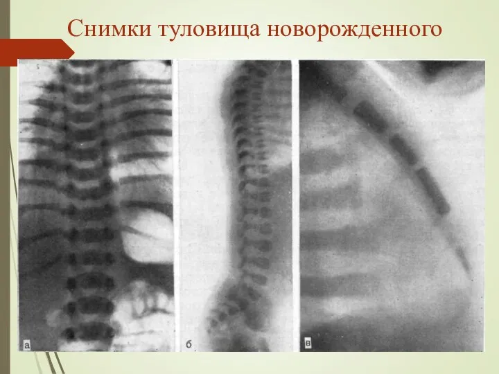 Снимки туловища новорожденного