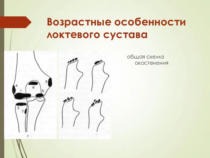 Возрастные особенности локтевого сустава общая схема окостенения