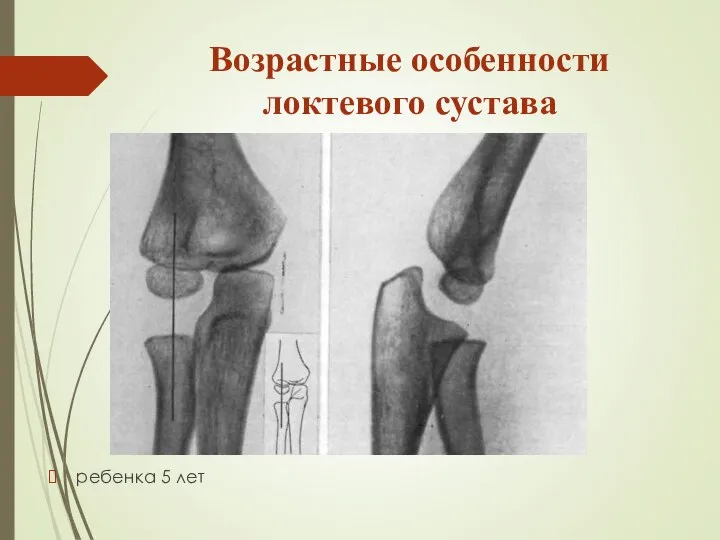 Возрастные особенности локтевого сустава ребенка 5 лет