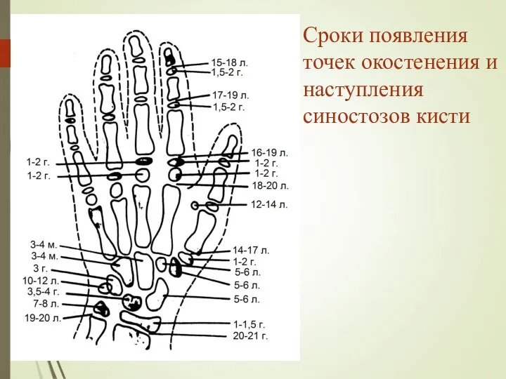 Сроки появления точек окостенения и наступления синостозов кисти