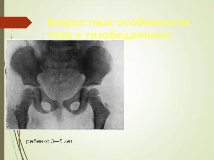 Возрастные особенности таза и тазобедренных суставов ребенка 3—5 лет