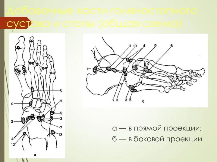 Добавочные кости голеностопного сустава и стопы (общая схема) а — в прямой