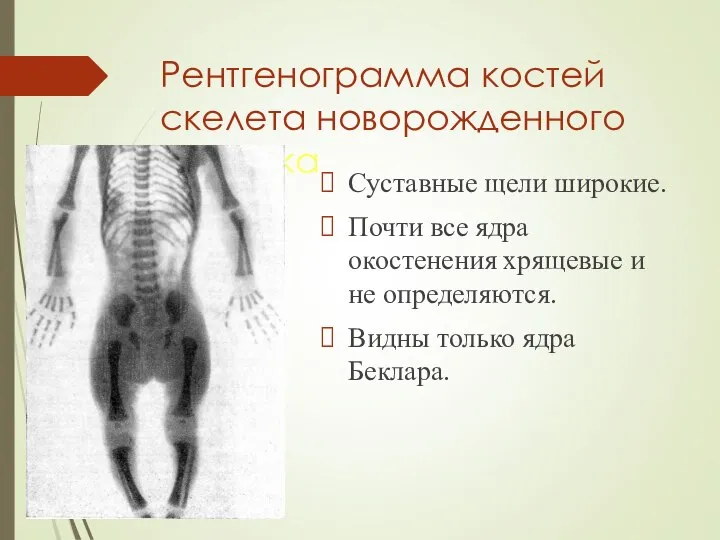 Рентгенограмма костей скелета новорожденного ребенка Суставные щели широкие. Почти все ядра окостенения