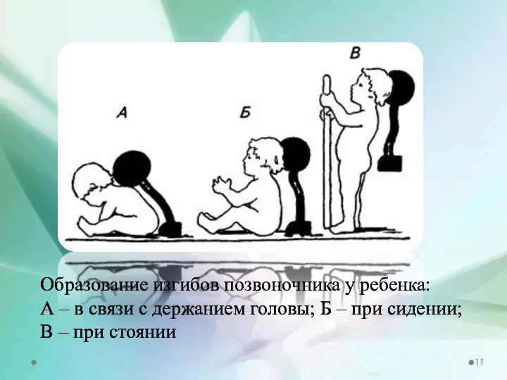 Образование изгибов позвоночника у ребенка: А – в связи с держанием головы;