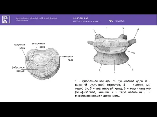 Центр дополнительного профессионального образования 1 – фиброзное кольцо, 2- пульпозное ядро, 3