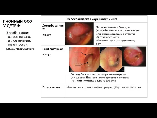 ГНОЙНЫЙ ОСО У ДЕТЕЙ: 3 особенности: - острое начало, - вялое течение,
